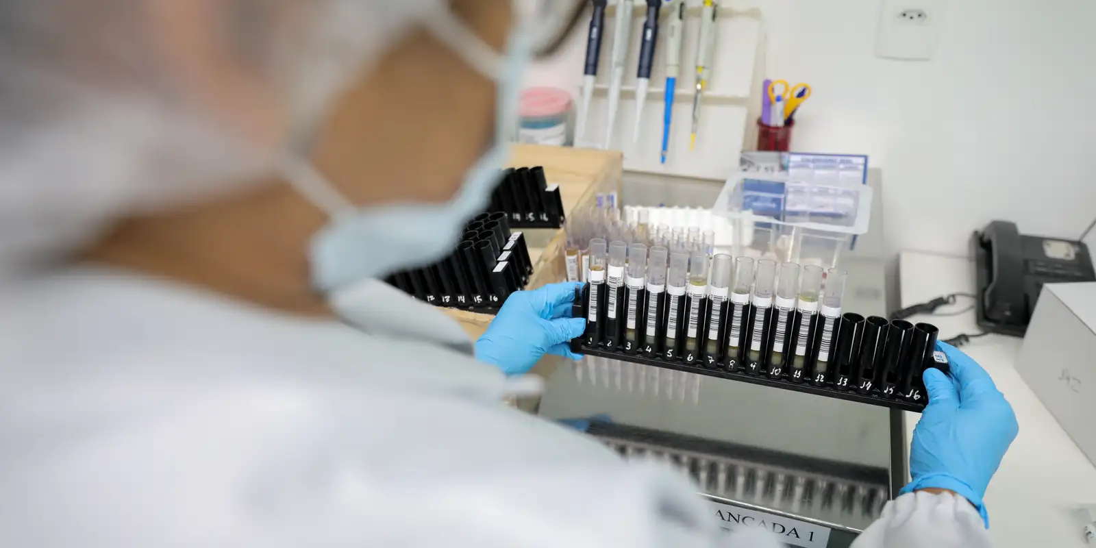 malaria:-anvisa-autoriza-teste-em-humanos-de-vacina-100%-brasileira